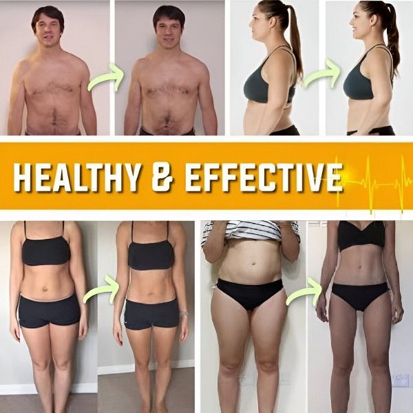 Pas redukujący tkankę tłuszczową i cellulit | SHAPEUP